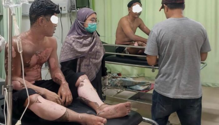 Kapal Diduga Milik KSOP Sintete Terbakar, Dua Orang Alami Luka Bakar Serius